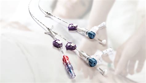 Three Go Catheters: Improving Quality of Life for Patients with Chronic Catheter Use